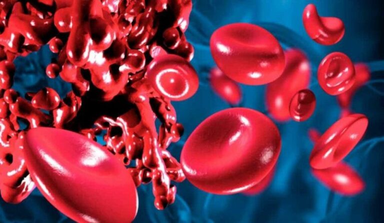 Alimente care subțiază sângele și reduc riscul de tromboză