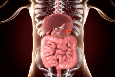 Descoperă fructul minune care combate anemia și protejează împotriva cancerului