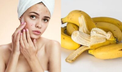Nu mai aruncați cojile de banană. Iată 7 utilizări esențiale ale lor.