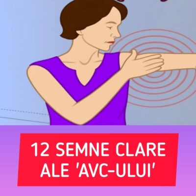 12 Semne de alarmă ale accidentului vascular cerebral (AVC)