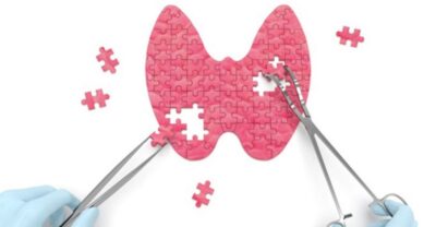 Tiroida hipoactiva: Trebuie sa stii care sunt valorile unui TSH normal