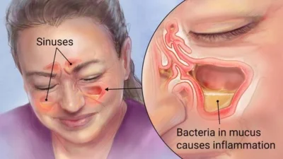 Ceaiul miraculos care combate durerile de gât și infecțiile respiratorii!