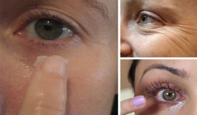 Recomandat femeilor de peste 40 de ani. Este eficient, absolut natural si e mai ieftin decat orice crema antirid
