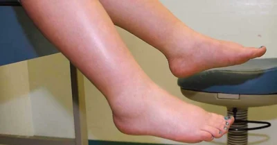 Top 7 ceaiuri naturale care elimină rapid retenția de apă și umflăturile!