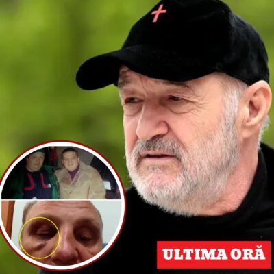 Bărbatul care a vandalizat gardul lui Becali, BĂTUT CRUNT după ce s-a întors acasă – certificat medico-legal confirmă agresiunea!