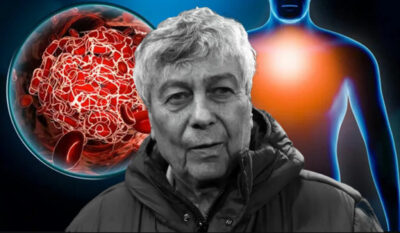 Ce inseamna focarele de tromboembolism pulmonar care au fost descoperite in cazul lui Mircea Lucescu, inainte de deces