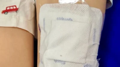 Băiețel de șase ani, ajuns în comă la spital după ce sora lui i-a pus pe o zgârietură plasturi care conțineau fentanyl